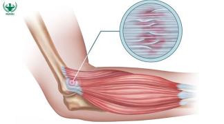 Phân biệt gân cơ và dây chằng: Cấu tạo và vai trò trong vận động